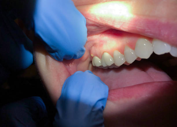 Best Emergency Treatment for Toothache in Copeland, OK