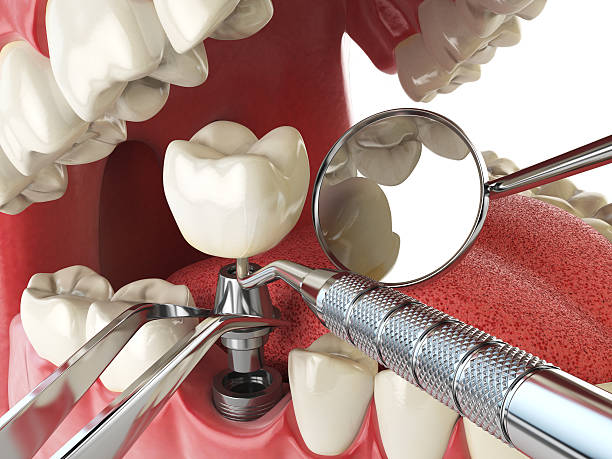Best Emergency Dental Surgery in Copeland, OK